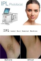 Professional IPL laser hair removal machine. The best IPL laser machine brand-BVLASER-1