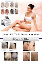 Wholesale ND YAG laser tattoo removal machine. ND YAG laser dermatology. China Q-switched ND YAG laser machine manufacturer-BVLASER.-1