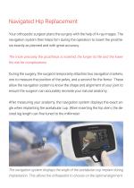 Navigated Hip Replacement-2
