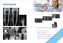 Digital X-ray system Staray 5000Super_EC/EZ/Z-3