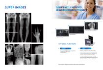 Digital X-ray system Staray 5000Super Smart-4