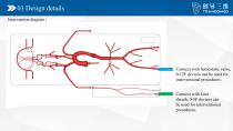 Neuro vascular A-9
