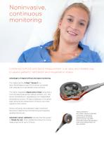 SenTec V-Sign™ Illuminate Ventilation and Oxygenation-3