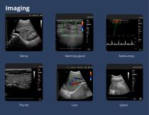 Hand-held ultrasound system S35L - 3