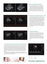 On-platform ultrasound system GT8 - 6