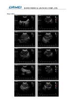 Dawei Color Doppler Ultrasonic System L5-VET-5