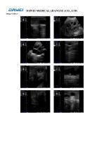 Dawei Handheld Ultrasound S1-4