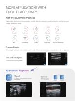 DW-F3i Trolley Color Ultrasonic Apparatus (AI-assisted diagnosis)-4