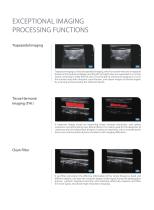 DW-L3 Laptop Full Digital Color Ultrasonic Diganostic Apparatus-5