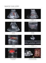 DW-T9 Dignostic Ultrasound System-7