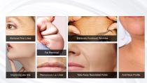 EXFU 11 D HIFU skin rejuvenation (2025)-5