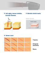 CO2 Fractional laser Scar removal skin rejuvenation machine Z-CO-60-5