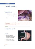 Shenyun Medical Gastric calibration tube SY-01-8