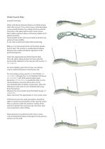 Clavicle Plates Surgical Technique-7