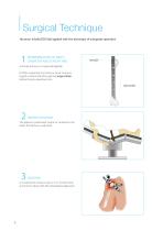 humerus InSafeLOCK Nail-6