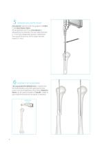humerus InSafeLOCK Nail-8
