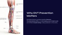 Deep Vein Thrombosis Prophylaxis System FP 4 SSP DIGITAL-2