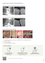 Curodont™Repair Fluoride Plus-2