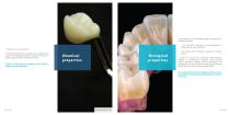G-CAM Graphene reinforced biopolymer dise for CAD/CAM milling. For definitive prosthesis.-6