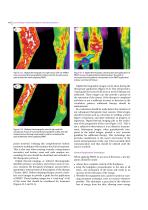 JZGGD003 Laser Physiotherapy-6