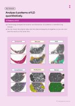 aview: Lung Texture-3