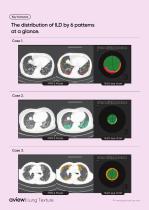 aview: Lung Texture-4