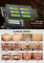 2in1 machine laser hair removal+Nd yag tattoo removal-3
