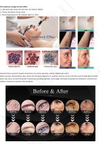 All color tattoo removal carbon peeling pigment removal-6