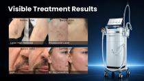 EXFU M3--The best advanced multi-function beauty machine-23