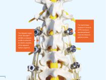 SpineShape.-3