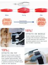 4 handle Ems muscle stimulator-3