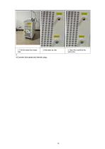 755nm 1064nm Alexandrite long pulse laser hair removal-14