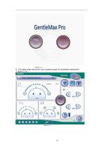 755nm 1064nm Alexandrite long pulse laser hair removal-18