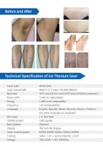 Hair removal laser Soprano Ice 4-6