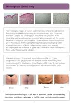 Microwave body contouring unit Coolwaves-6