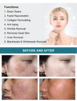 Oxygen+Hydrofacial 7 handle-8