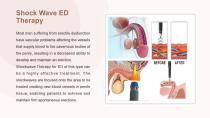 Shockwave ESWT-12