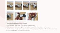 Shockwave ESWT-13