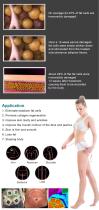 truSculpt ID-3