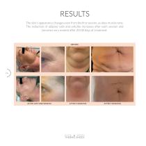 FACE & BODY THERMO SHOCK-14