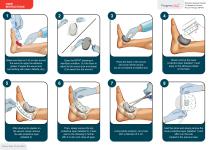 Wound Dressing Application Instuctions - EN-1
