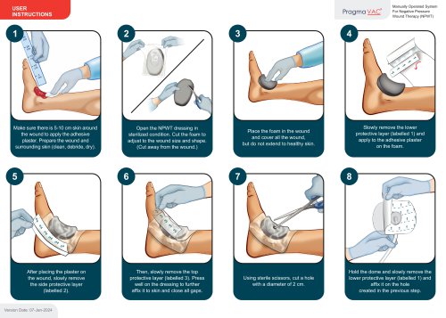 Wound Dressing Application Instuctions - EN