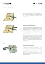 CERVICAL PEEK-6