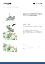 MONZA LUMBAR PLIF TLIF-11