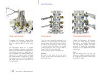 VENUS® Fixation-10