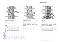 VENUS® Fixation-7