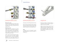 VENUS® Fixation-8