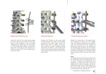 VENUS® Fixation-9