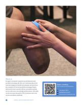 Innovative Technology Revolutionizing Prosthetics-2