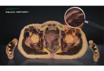 Digihuman Virtual Anatomy Table-4